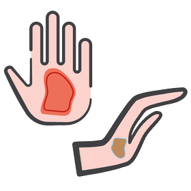 AWM_wound_type_body_illustration_hand.png