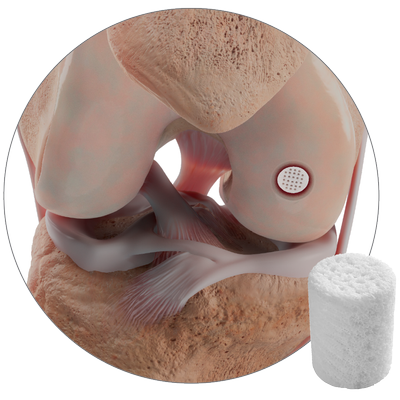 41813 CARTIHEAL Product Page Hero Image V2