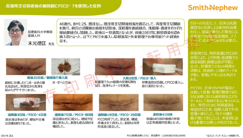 iPICOケースカード_末光先生.jpg