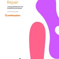 23836-v5-speedlock-hip-technique-guide-digital-0422.pdf