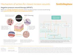 42479-uki PICO MoA single sheet for closed incision wounds 04-24.pdf