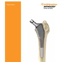 Surgical Technique: ANTHOLOGY™