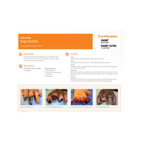 OASIS Case Study: Finger Frostbite