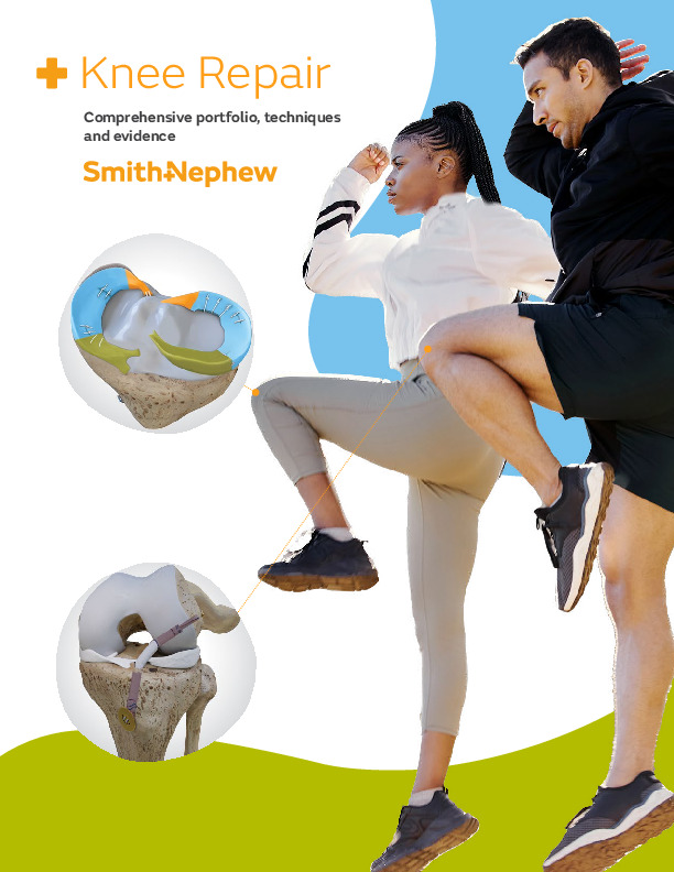 Reimagine reconstruction Knee Ligament Solutions brochure