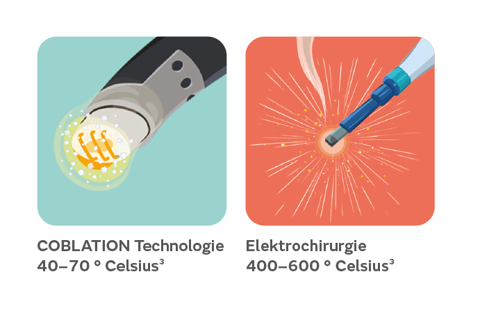 Coblation-Electrosurgery