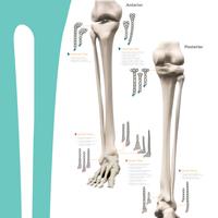EVOS SMALL - Plattensystem Untere Extremität Poster