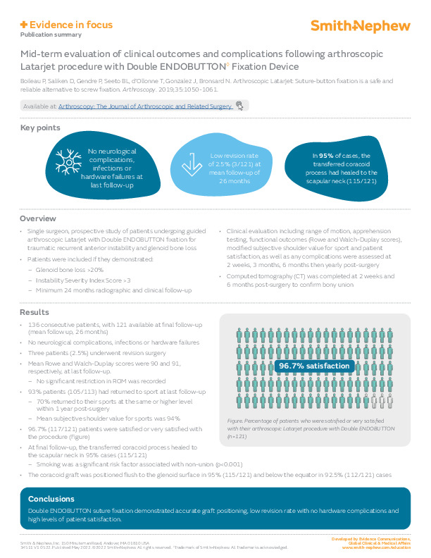 Double ENDOBUTTON Evidence in focus Boileau