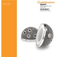 REDAPT Modular Cup Surgical Technique