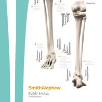 EVOS SMALL Skeleton Overview Poster - Lower Extremity
