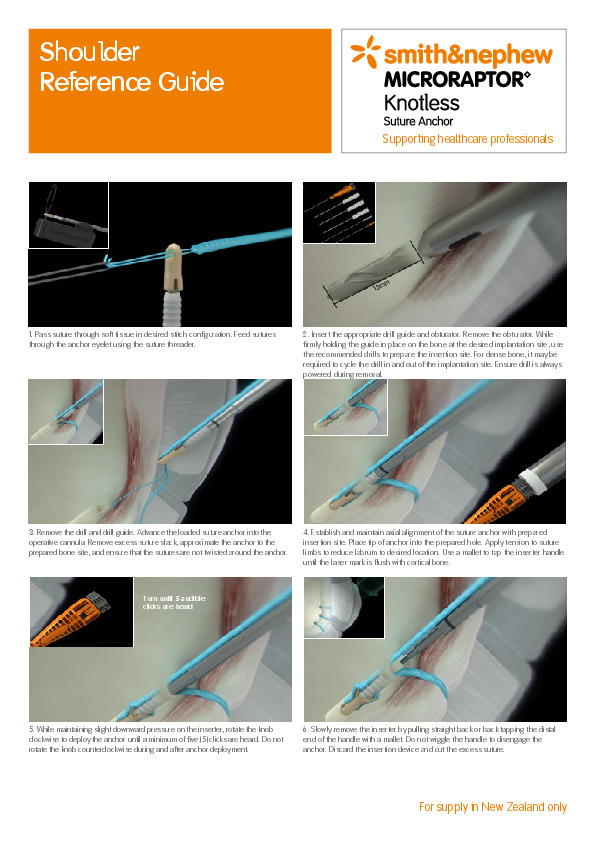 MICRORAPTOR KNOTLESS Shoulder Reference Guide (NZ)