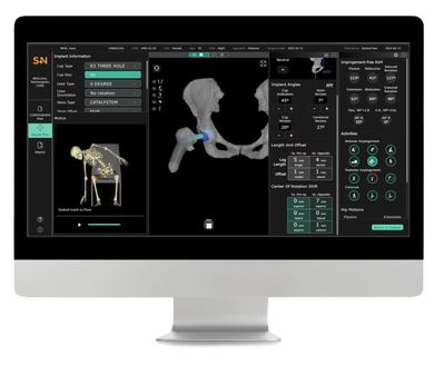CORIOGRAPH Hip Main Body Image
