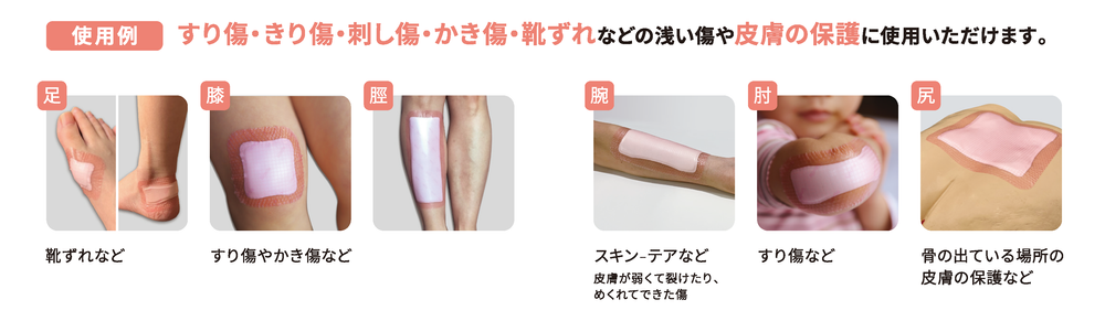【極美品】創傷の治癒 Wound healing Amazon.com: Dr. Schavit Ultraheal 天然傷口癒合凝膠– 水活性