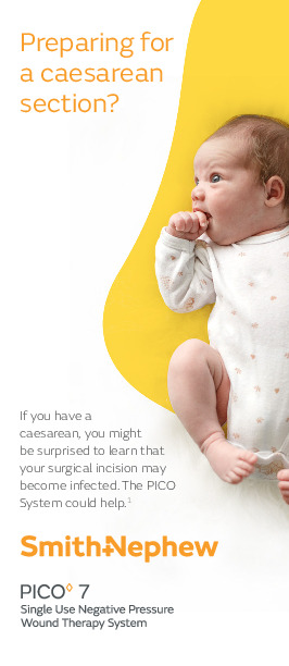 PICO OBGYN Consumer Brochure