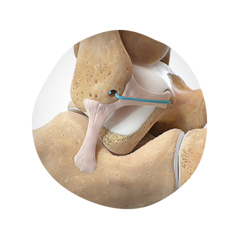 ULTRABRACE Hero 2.png