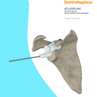 ATLASplan Surgical Technique