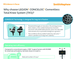 LEGION CONCELOC Cementless TKS clinical evidence infographic