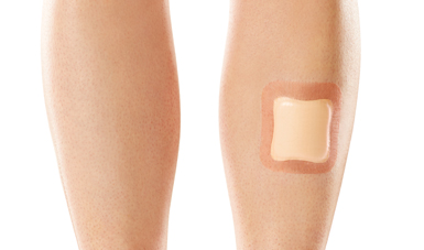 allevyn-adhesive-foam-dressing.jpg
