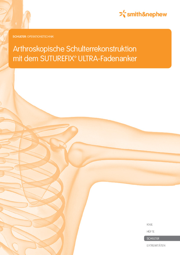 SUTUREFIX ULTRA - OP-Technik
