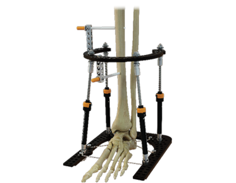 ACUTE QUICK CONNECT STRUTS hero image