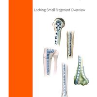 PERI-LOC Small Frag Surgical Technique