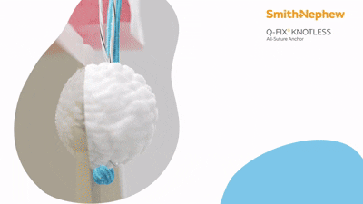 Q-FIX Knotless Highlights.gif