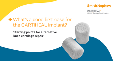 48593-9-V1-KNE-CARTIHEAL-blog-Trochlea-case-F-0126 