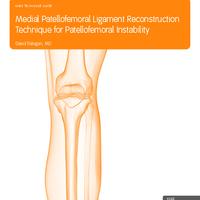 BIOSURE Medial Patellofemoral Technique Guide