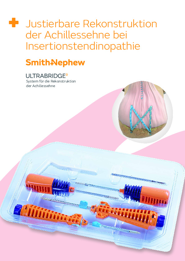 Small Joint - ULTRABRIDGE - Bestellinfo - 40738-de