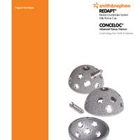 REDAPT Revision Acetabular Cup Surgical Technique