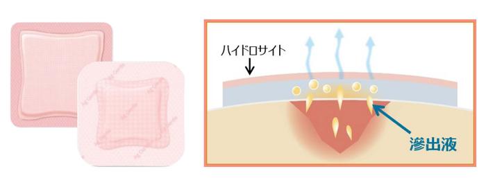 ハイドロサイト？創傷被覆材とは？