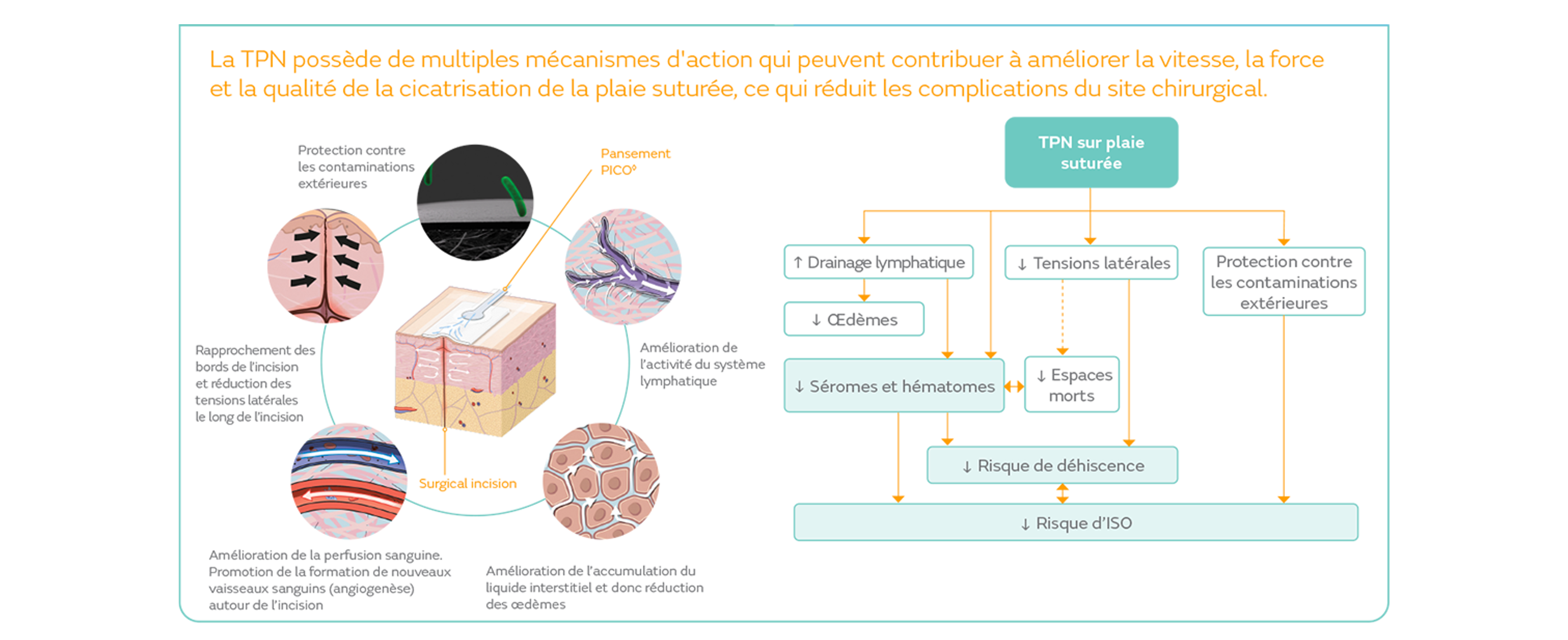 MoA PICO - Breast Campaign.png