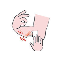 JP Consumer - Wound Information - Skin Tears - Card 2