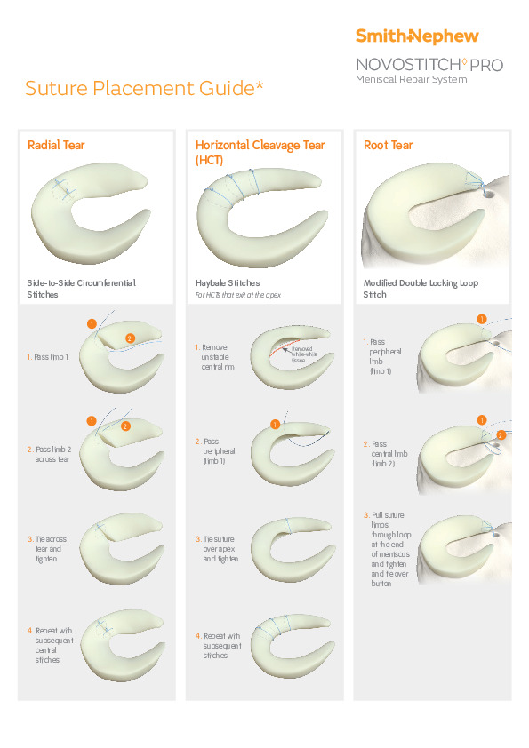 NOVOSTITCH PRO Suture Placement Guide