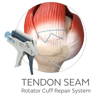 50777-15-V1-AOSSM-web-TENDONSEAM-1X1-0626.png