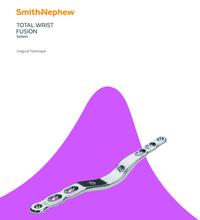 TOTAL WRIST FUSION System Surgical Technique