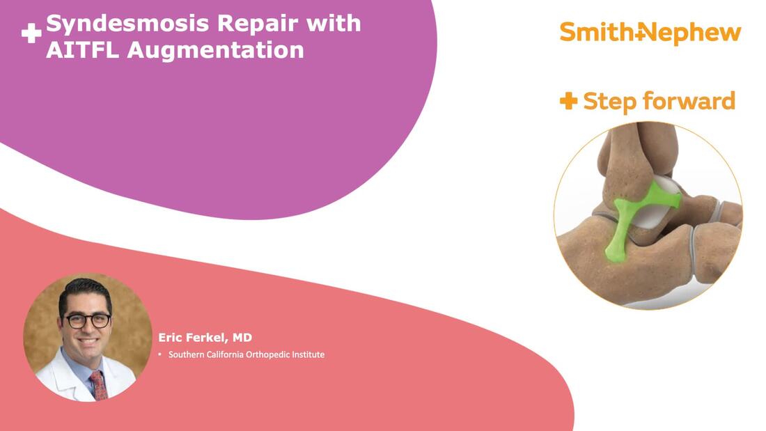 Syndesmosis Repair with AITFL Augmentation featuring Dr. Eric Ferkel
