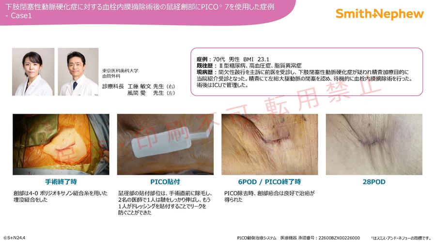 iPICO血管外科CR_鼠径部縫合創_工藤先生、風間先生.jpg