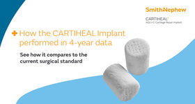 48593-9-V1-KNE-CARTIHEAL-blog-2-F-0126