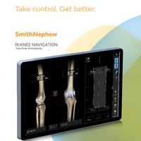 RI.KNEE NAVIGATION Sales Sheet