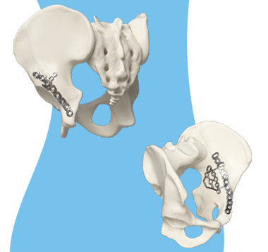 EVOS PELVIC Icon 4- The all-in-one advantage