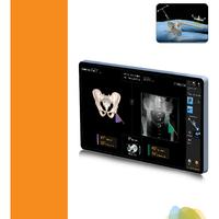 RI.HIP NAVIGATION Lateral Position Surgical Technique