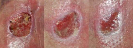 20250321_PICONHW_CaseStudy_a