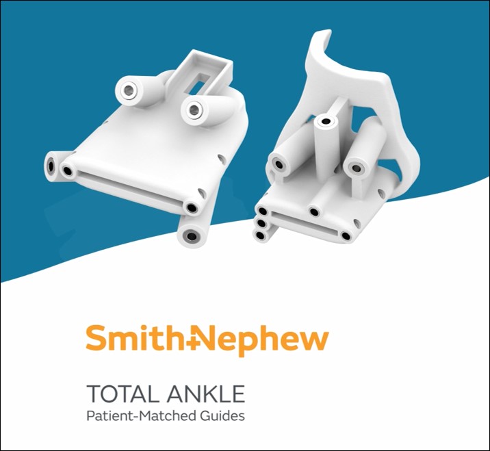 Smith+Nephew brings pre-operative planning and accuracy to total ankle replacement with new TOTAL ANKLE Patient-Matched Guides