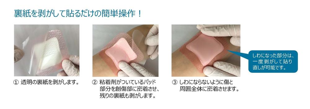 【極美品】創傷の治癒 Wound healing 傷の回復を電気刺激で25%速くする「スマート絆創膏」を開発