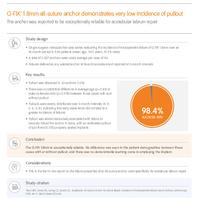 Evidence in Focus: Q-FIX 1.8mm demonstrates very low incidence of pullout