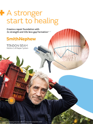 TENDON SEAM Rotator Cuff Repair System brochure