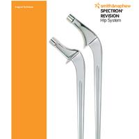 SPECTRON Revision Hip System Surgical Technique