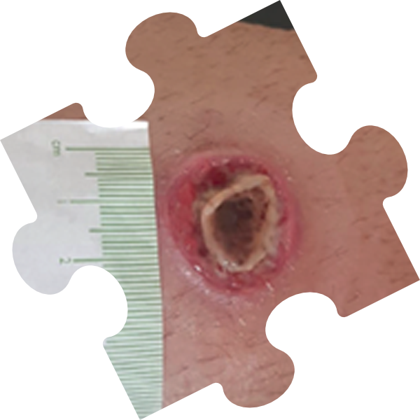 clinical case puzzle.png