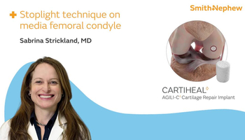 CARTIHEAL Stoplight Technique featuring Dr. Sabrina Strickland