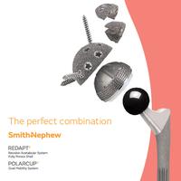 REDAPT Fully Porous Cup with the Cement-In POLARCUP Sales Sheet